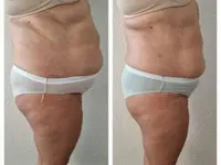 Therapie Serra Massage