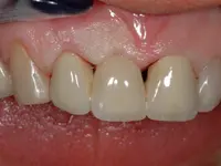 Gutzwiller Dental - Klicken Sie, um das Bild 7 in einer Lightbox vergrössert darzustellen