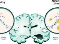 NeurologiePraxis dr. Celik - Klicken Sie, um das Bild 3 in einer Lightbox vergrössert darzustellen